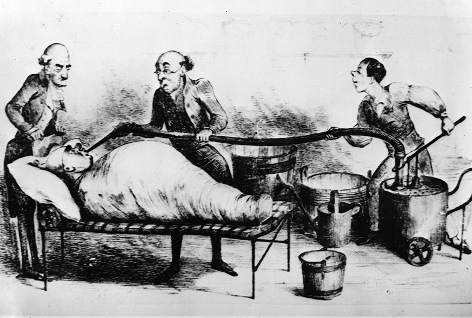 Накачивание водой больного артритом (1846 год)